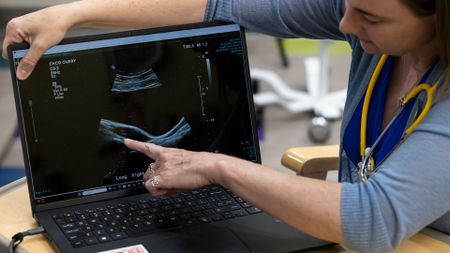 A woman points to an ultrasound image on a laptop.