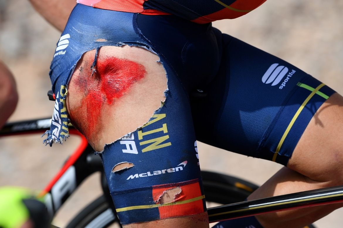 Domenico Pozzovivo (Bahrain-Merida) suffered some nasty road rash