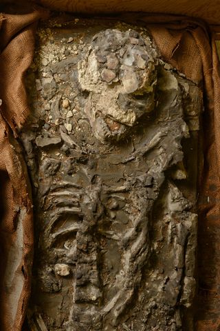 Here, a close-up of the upper body and skull of the 6,500-year-old skeleton discovered at the site of Ur. The teeth are well preserved.