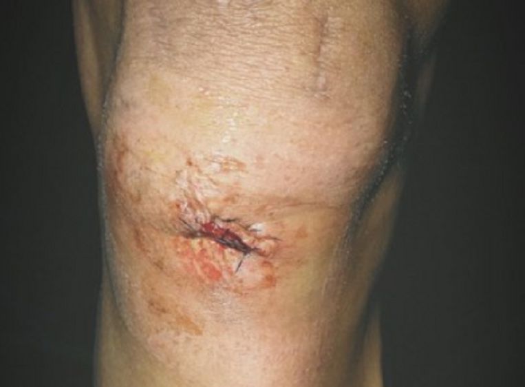 A close up shot of Mathieu van der Poel's knee