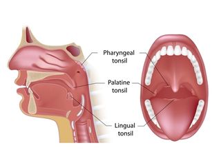 tonsil types