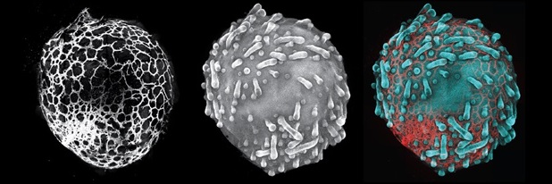 photo showing three spheres alongside each other; each shows a different view of a skin organoid