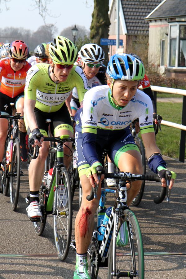 An Orica rider sports a wound from a crash