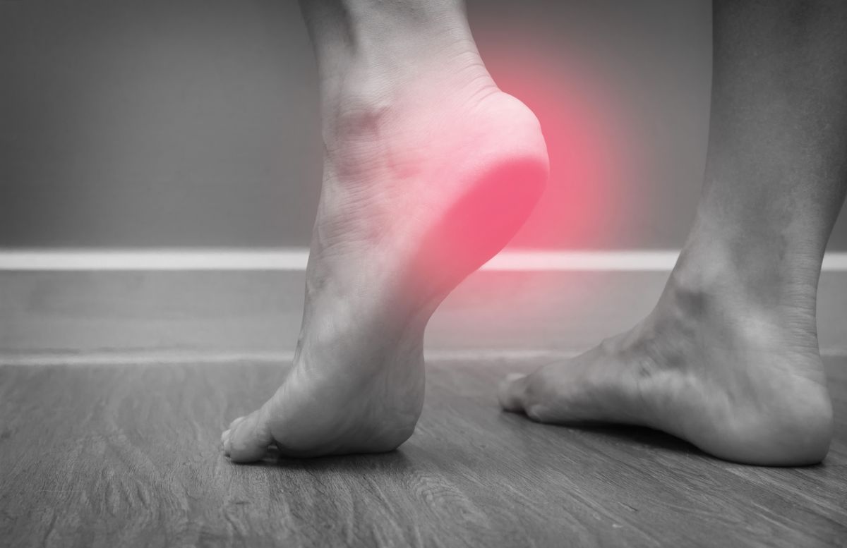 over the counter medicine for plantar fasciitis