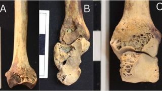 A triptych of bone images 