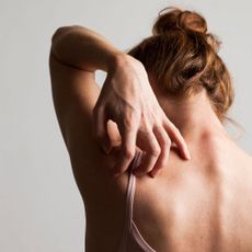 How to avoid bedbugs: A woman scratching her back
