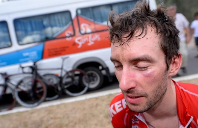 Kenny Dehaes shows off his new shiner