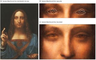 "Salvator Mundi," a painting recently attributed to Leonardo da Vinci may provide evidence that the artist had an eye condition called strabismus, according to a new paper.