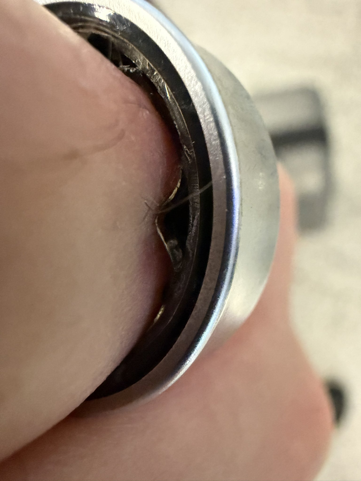 Swollen Samsung Galaxy Ring on the finger of Daniel Rotar