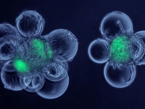 This micrograph shows cells called myoblasts attached to spherical microcarriers, which allow the growth of adult stem cells that have been isolated from skeletal muscle. The stem cells are shown in green.