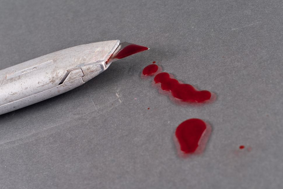 Why Do People Cut Themselves? Cutting PTSD Live Science