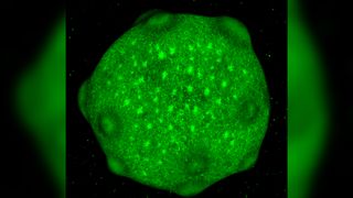 Fluorescent images illustrating cell types in brain organoids.
