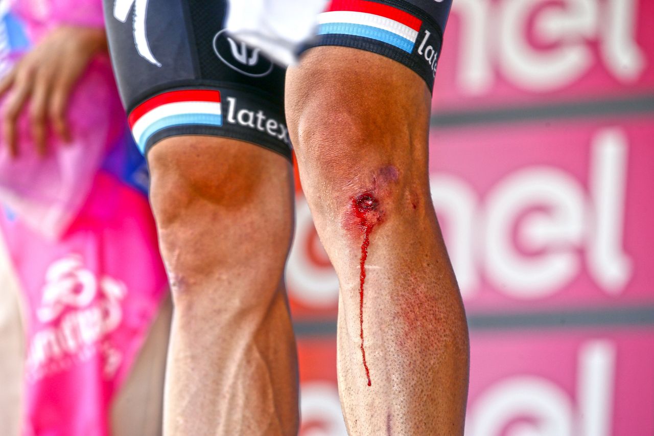 Blood on the knee of Bob Jungels (Quick-Step) who had a minor spill on stage 8