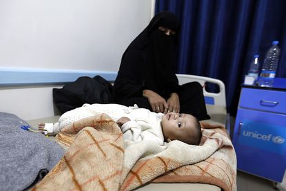 A Yemeni baby suspected of having cholera.
