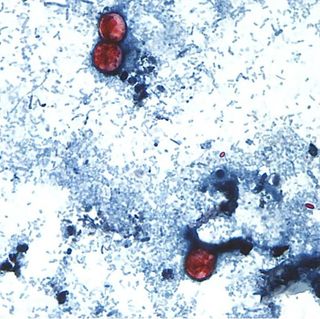 The parasite <em>Cyclospora</em> can cause intestinal illness. Above, an image taken with a microscope showing <em>Cyclospora</em> eggs (red) in a stool sample.
