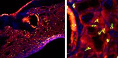 tuft cells