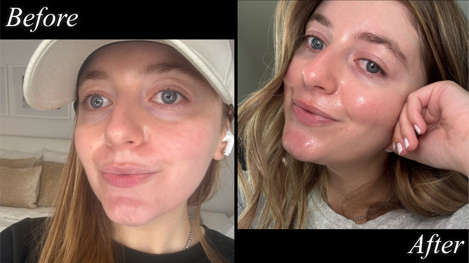 Samantha Holender pictured before and after testing Murad&#039;s toner.