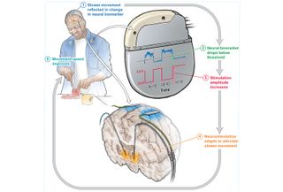 A diagram showing how the device responds to real-time feedback from the brain to deliver dynamic stimulation