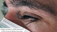 close up of a man's closed eye, showing his very, very long, dark and curly eyelashes