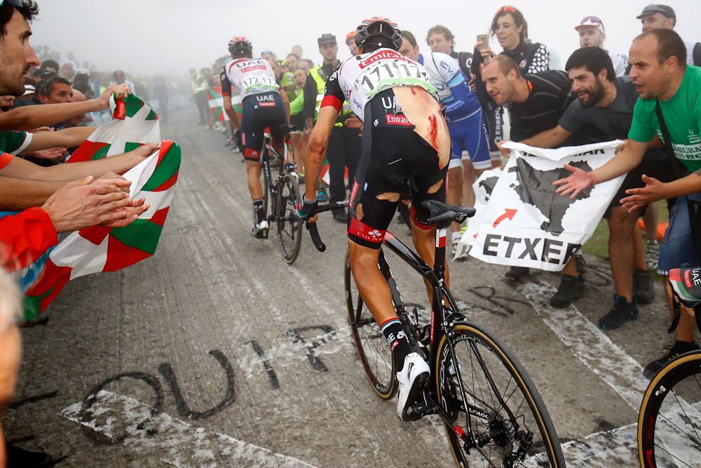Fabio Aru's kit shows the damage from a crash during stage 17 at the Vuelta