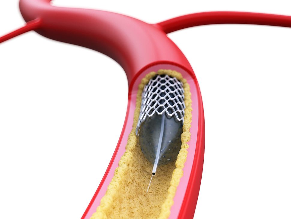 Venen und Arterien: Fakten über unsere Blutgefäße - Tech News