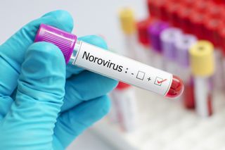 Neurovirus