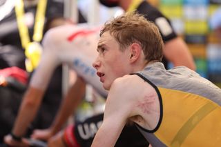 Jonas Vingegaard shows some road rash after crashing on stage 15 of the Tour de France