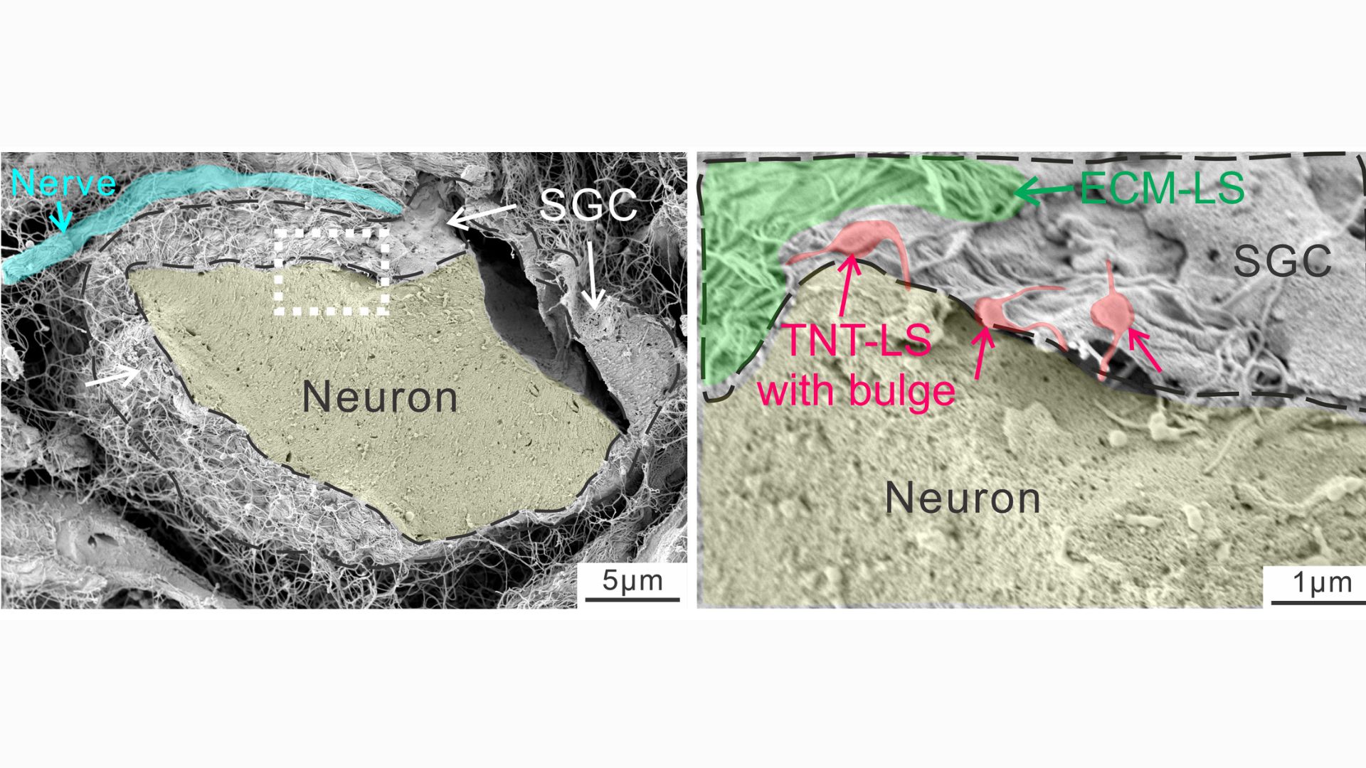 two images show a neuron and glial cell and tiny tubes connecting the two
