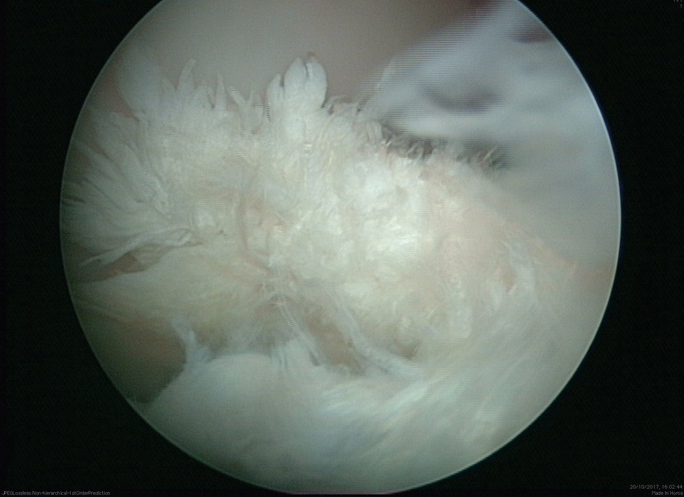 HAH299.vet_.medial_meniscus_tear_free_content_comm.jpg