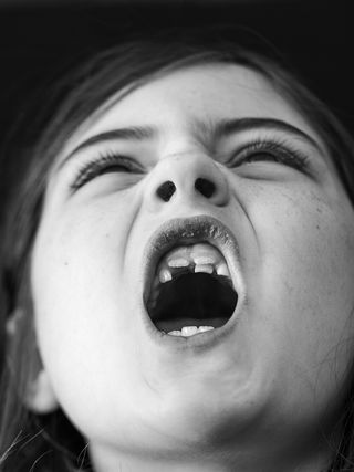 a child with mouth open showing teeth