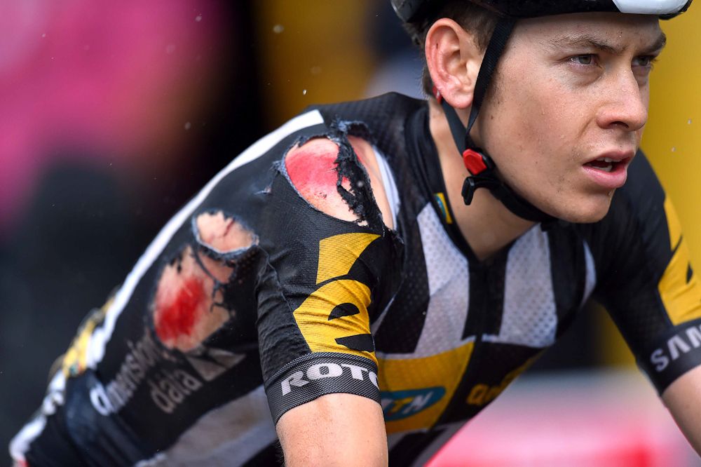 Louis Meintjes finishes stage 12 with a torn jersey from an earlier crash.