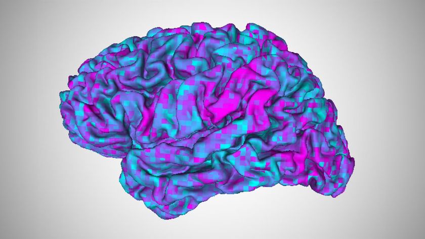 An image of the brain with color coded regions