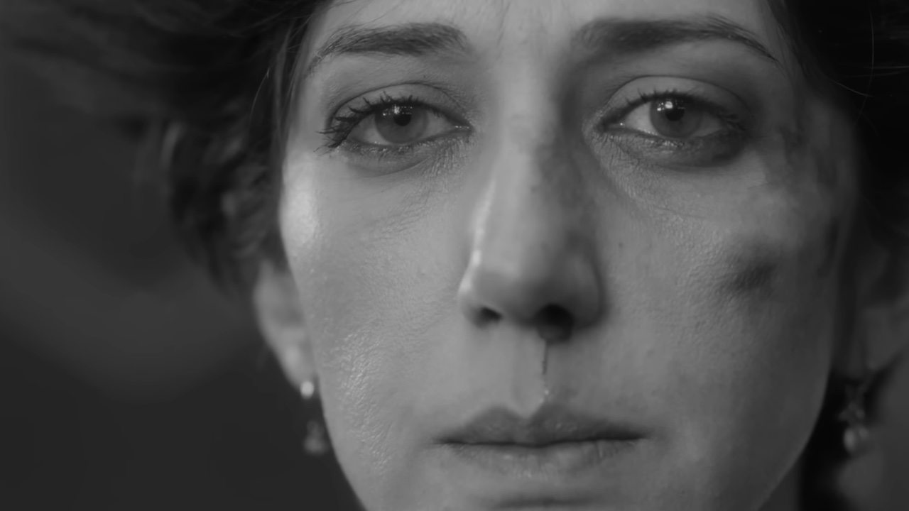 A woman with a bloody nose in Two People Exchanging Saliva