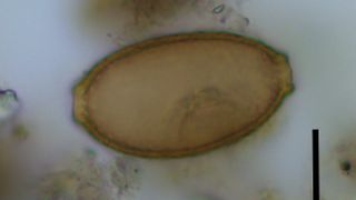 A capillariid worm egg.