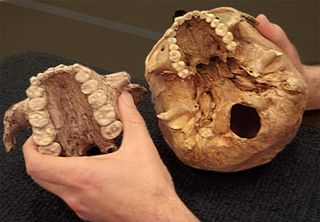 The extinct early human relative dubbed Nutcracker Man, Paranthropus boisei, had much larger teeth (left) than those of modern humans (right), as shown in these casts of two palates.
