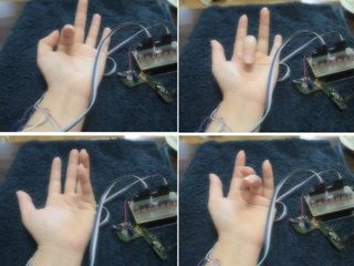 A prosthetic for musicians