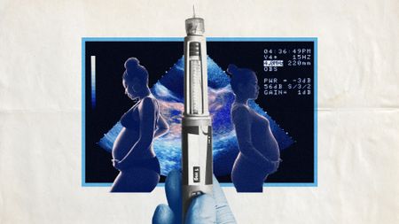 Photo collage of a large Ozempic syringe, flanked on either side with photos of two heavily pregnant women. In the background, there is a baby scan.