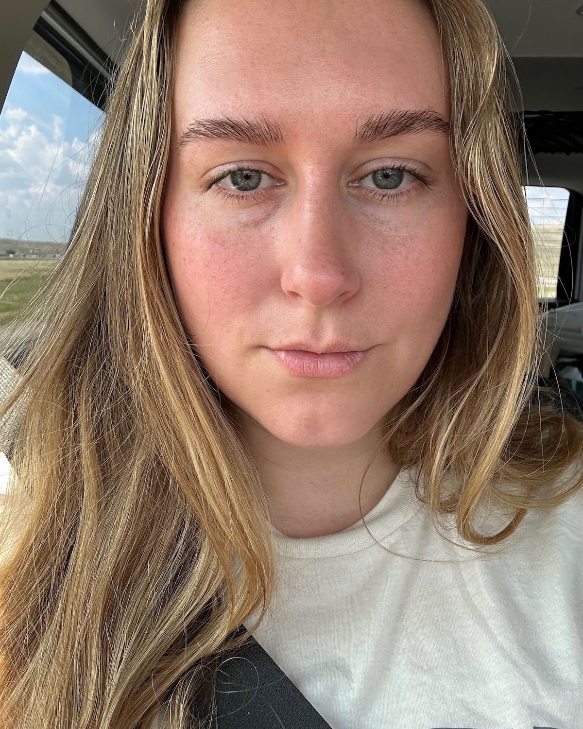 Beauty editor Kaitlyn McLintock before wearing Yse Beauty eye patches.