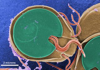 Giardia, a protozoa parasite that causes diarrhea and other stomach ailments