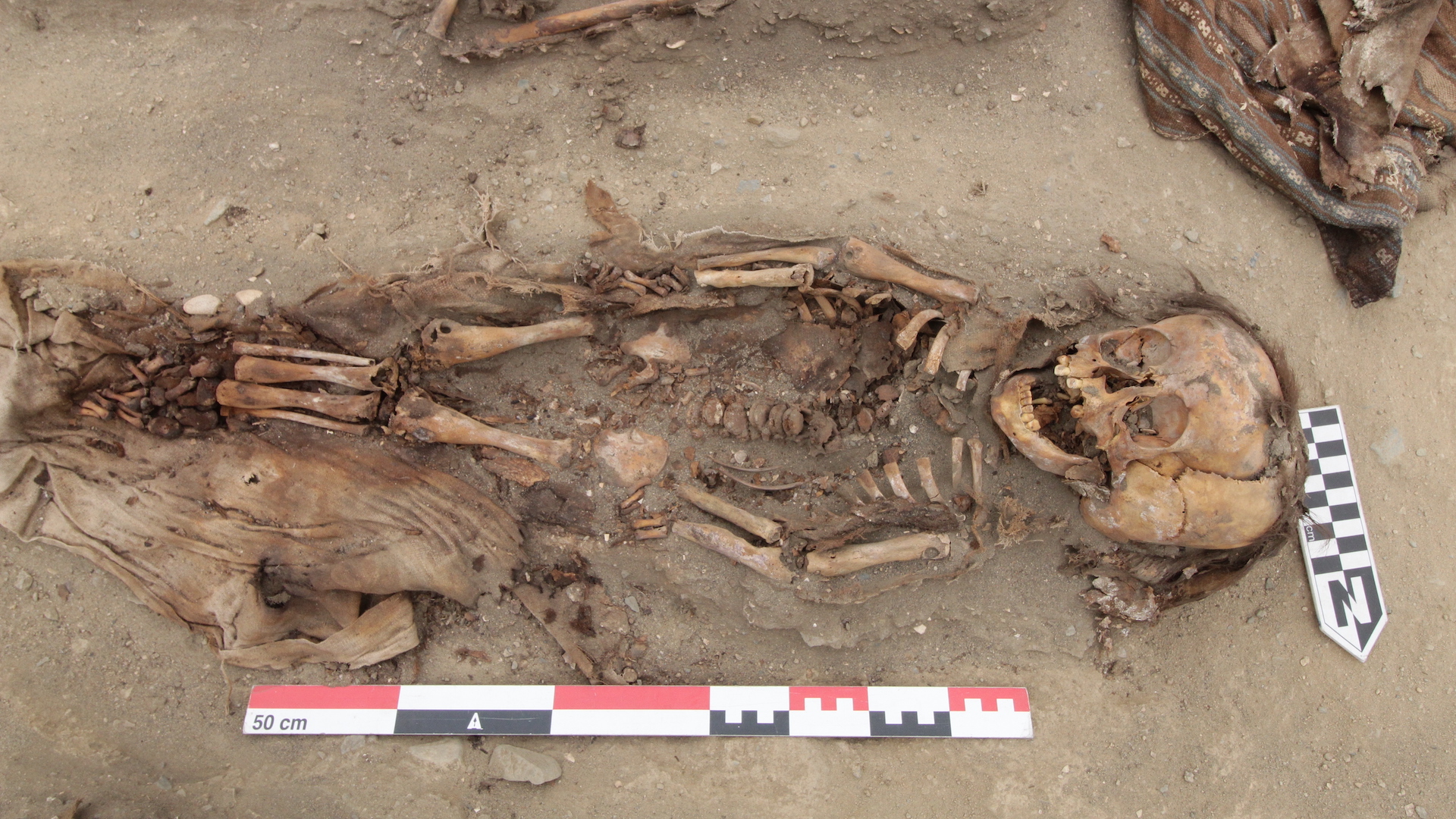 Skeletons of Incan kids buried 500 years ago found marred with smallpox