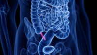illustration of the appendix, depicted in pink, extending off of the colon, depicted in blue