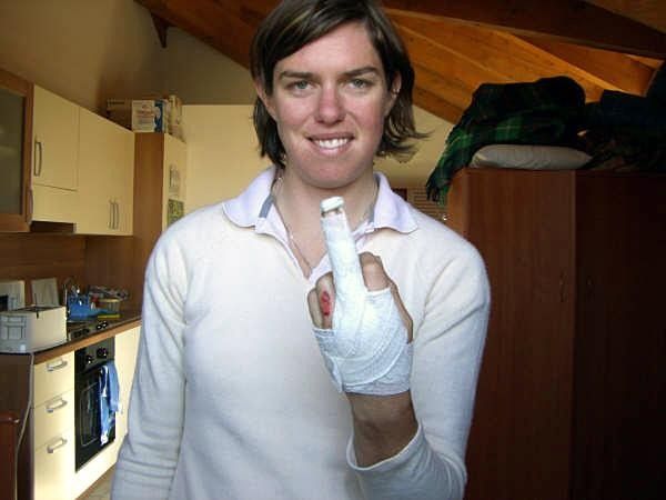 The sore hand&hellip;