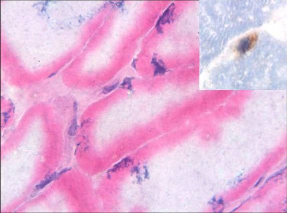 Human muscle collected 17 days after the death of the individual and harboring stem cells that are still alive (inset) and capable of being cultivated.