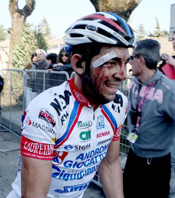 Scarponi wasn't as bad as Jose Serpa, shown here with a very bloody face after his crash.