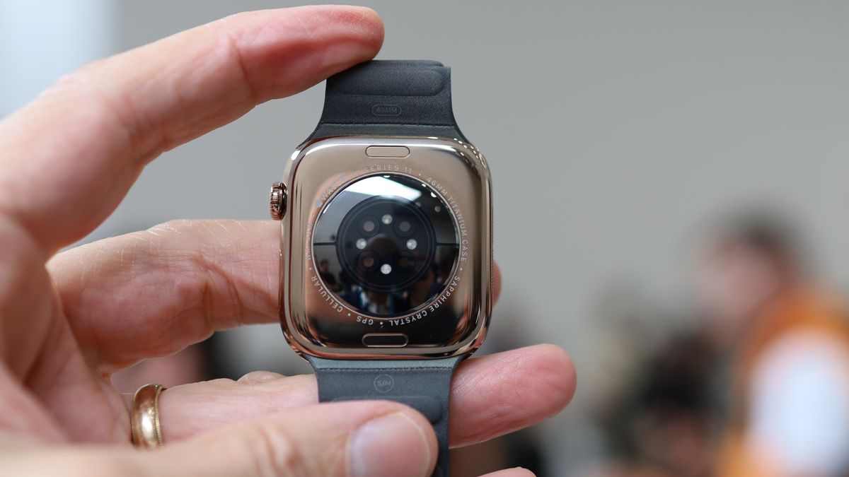 Apple Watch Series 11 in person