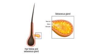 Cross section of sebaceous gland attached to a hair follicle