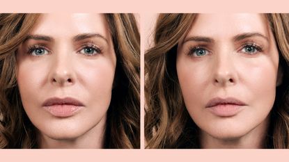 Trinny London Miracle Blur Lip and Line Filler
