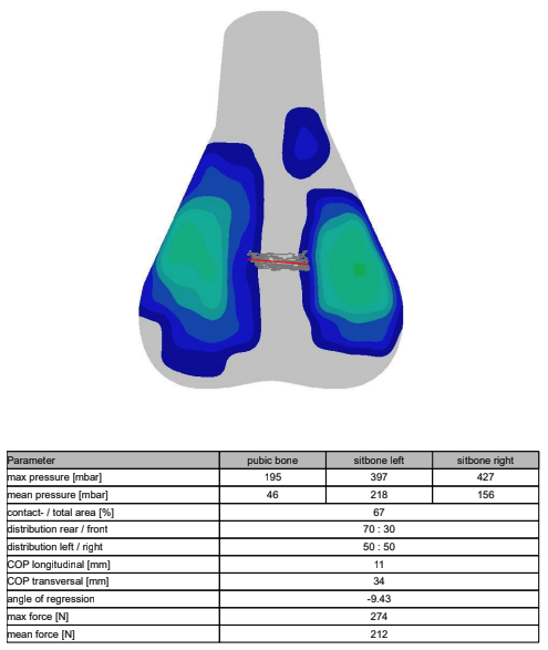 A visual output of saddle pressure mapping