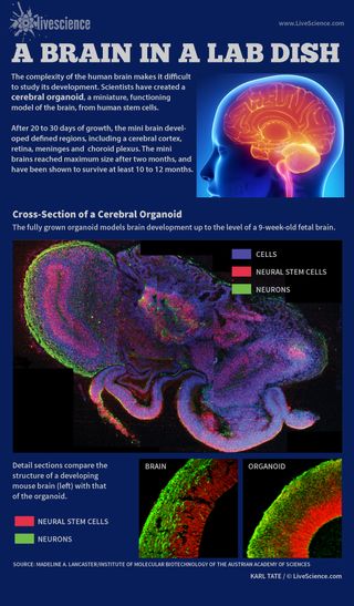 Infographic: a mini brain grown from human stem cells.