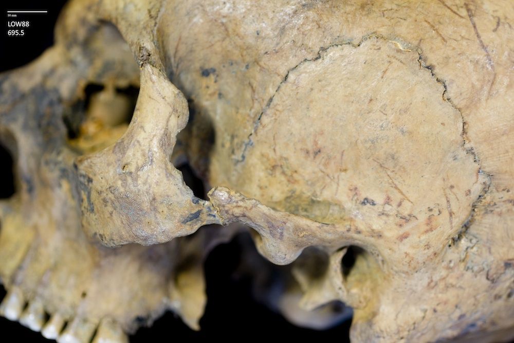 healed fractured cheekbone on fossil skull